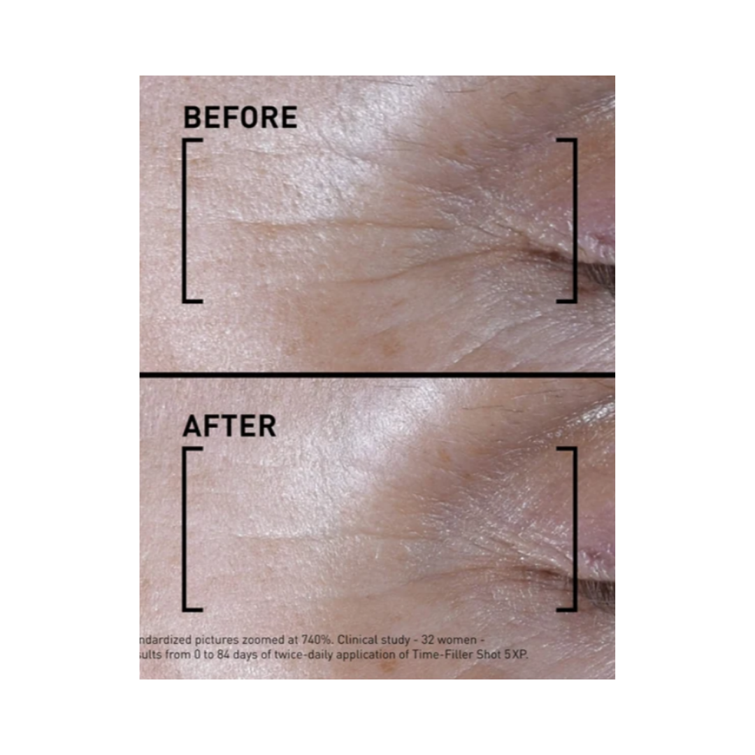 Filorga TIME-FILLER SHOT 5 XP Concentrated Serum Expression Lines - 15ml | فيلورجا سيروم مكثف للعناية بعلامات التقدم بالعمر المبكرة وخطوط التعبير - 15 مل