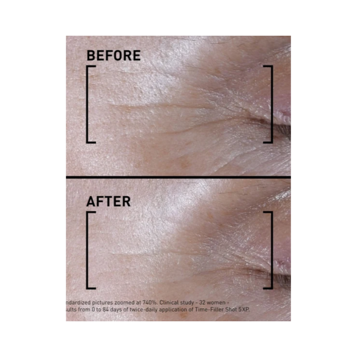 Filorga TIME-FILLER SHOT 5 XP Concentrated Serum Expression Lines - 15ml | فيلورجا سيروم مكثف للعناية بعلامات التقدم بالعمر المبكرة وخطوط التعبير - 15 مل