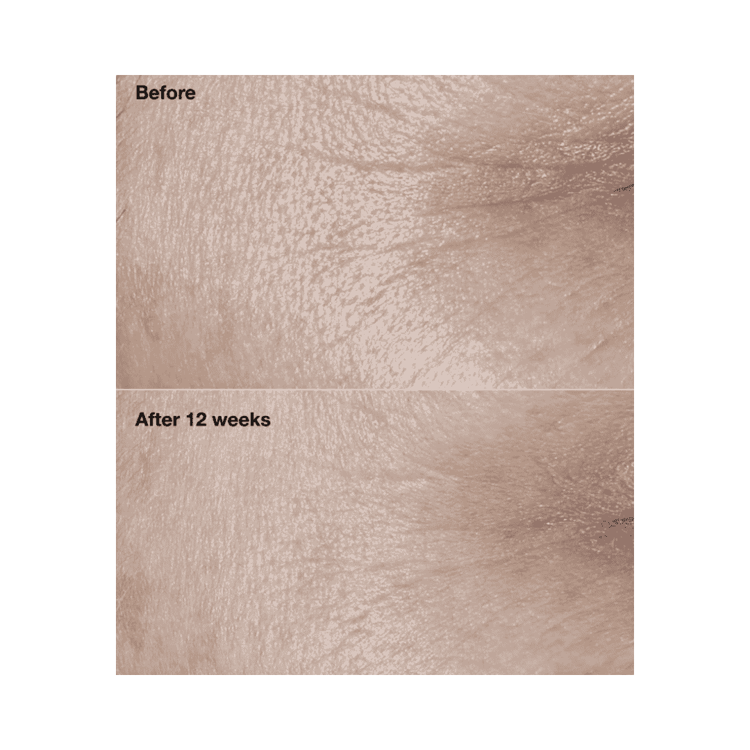 CLINIQUE Smart Clinical Repair Wrinkle Correcting Cream SPF30 - 50ml | كلينك كريم واقي شمسي مصحح للتجاعيد spf30 - 50 مل
