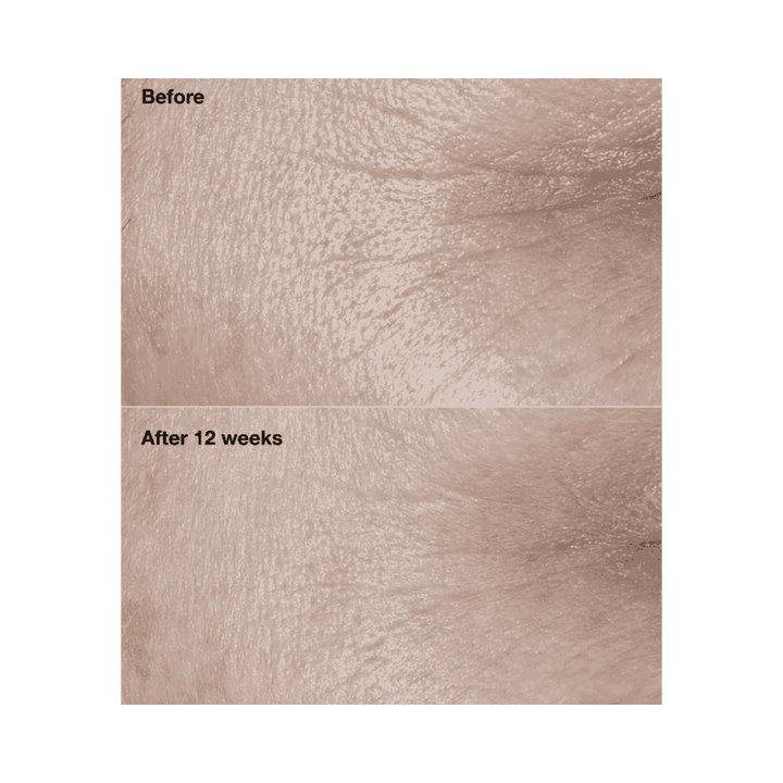 CLINIQUE Smart Clinical Repair Wrinkle Correcting Cream SPF30 - 50ml | كلينك كريم واقي شمسي مصحح للتجاعيد spf30 - 50 مل