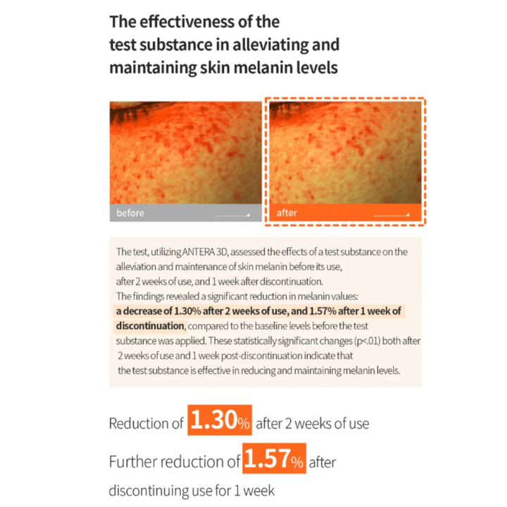 BENTON Vitamin C Serum - 30ml | بينتون سيروم فيتامين سي - 30 مل