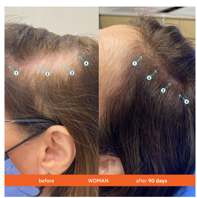 DS Labs Revita Hair Density Shampoo - 205ml | دي إس لابز ريفيتا شامبو كثافة الشعر - 205 مل