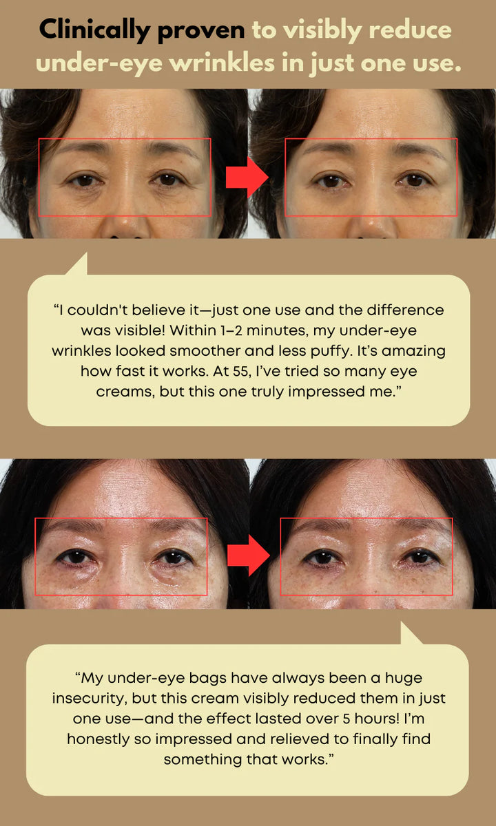 NINE LESS Dual Effect Eye Cream - 20ml | ناين ليس كريم تحت العين دول ايفيكت - 20 مل