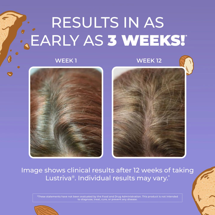 Mary Ruths Mary Ruths Hair Growth Max Liposomal Liquid Supplement Almond Cookie - 450ml | ماري روث مكمل غذائي سائل ليبوزومي بنكهة كوكي اللوز لدعم صحة الشعر - 450 مل