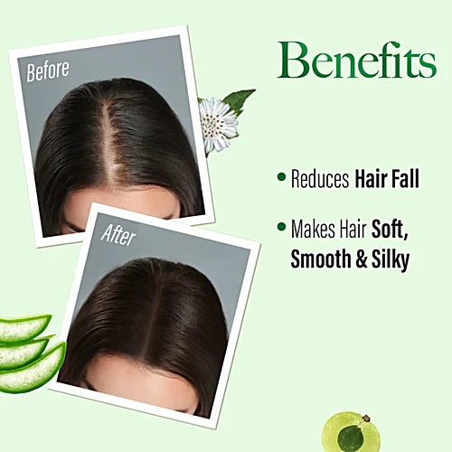 Kesh King Gold Anti-Hairfall Shampoo - 340ml | كيش كينغ شامبو مضاد لتساقط الشعر جولد - 340مل