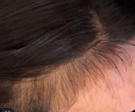 RAUSCH Original Hair Tincture Actively Combats Hair Loss - 200ml | راوش تونك لمكافحة تساقط شعر الرأس - 200 مل
