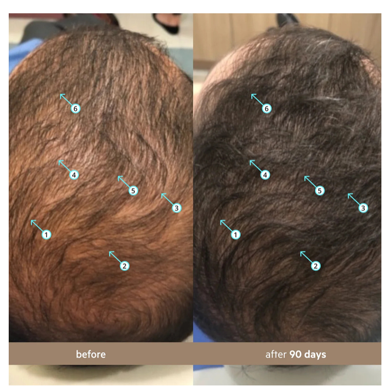 DS LABS Spectral Men's Advanced Hair Density Serum - 60ml | دي إس لابز سيروم متقدم لكثافة الشعر للرجال - 60 مل