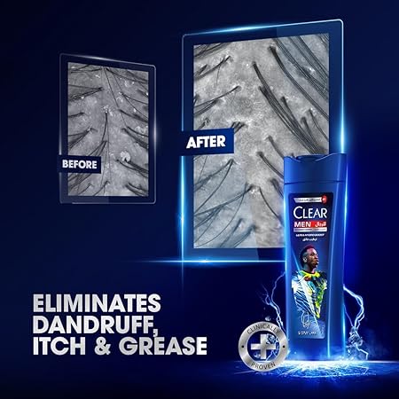 Clear Anti-dandruff Ultra Hydro Boost Shampoo For Men - 360ml | كلير شامبو ضد القشرة للرجال - 360 مل