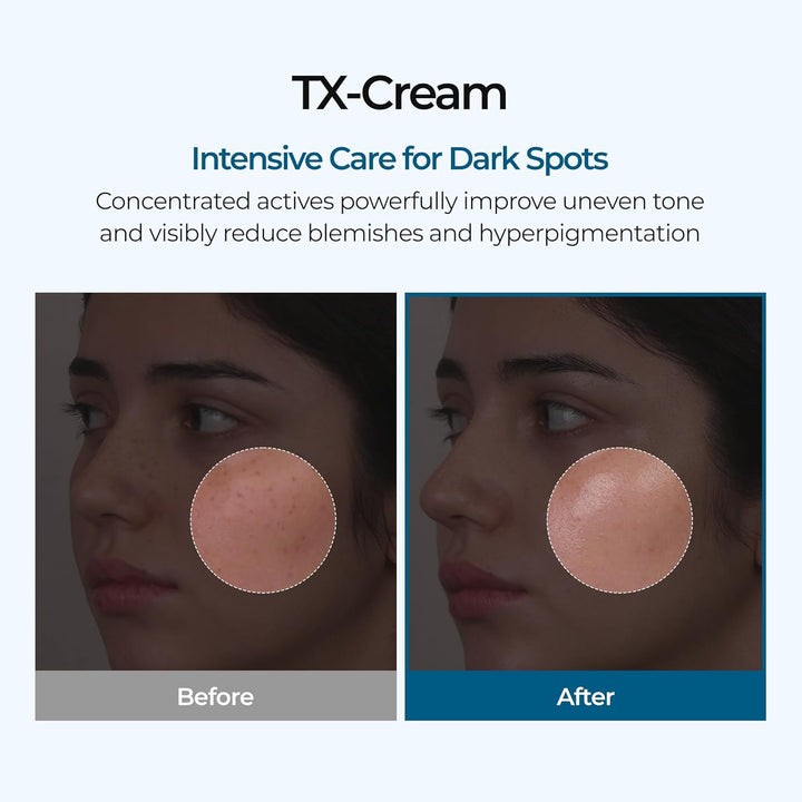 Dr.Melaxin TX Cream - 50g| د. ميلاكسن كريم لتفتيح وتوحيد لون البشرة – 50 غرام