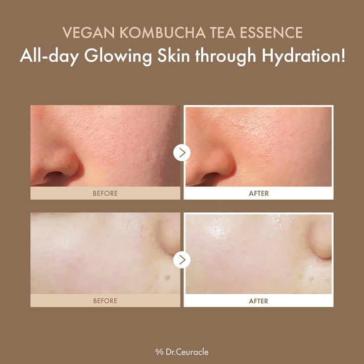 Dr.Ceuracle Vegan Kombucha Tea Essence - 150ml | دكتور سيراكل ايسنس خلاصة شاي الكمبوتشا النباتية - 150مل