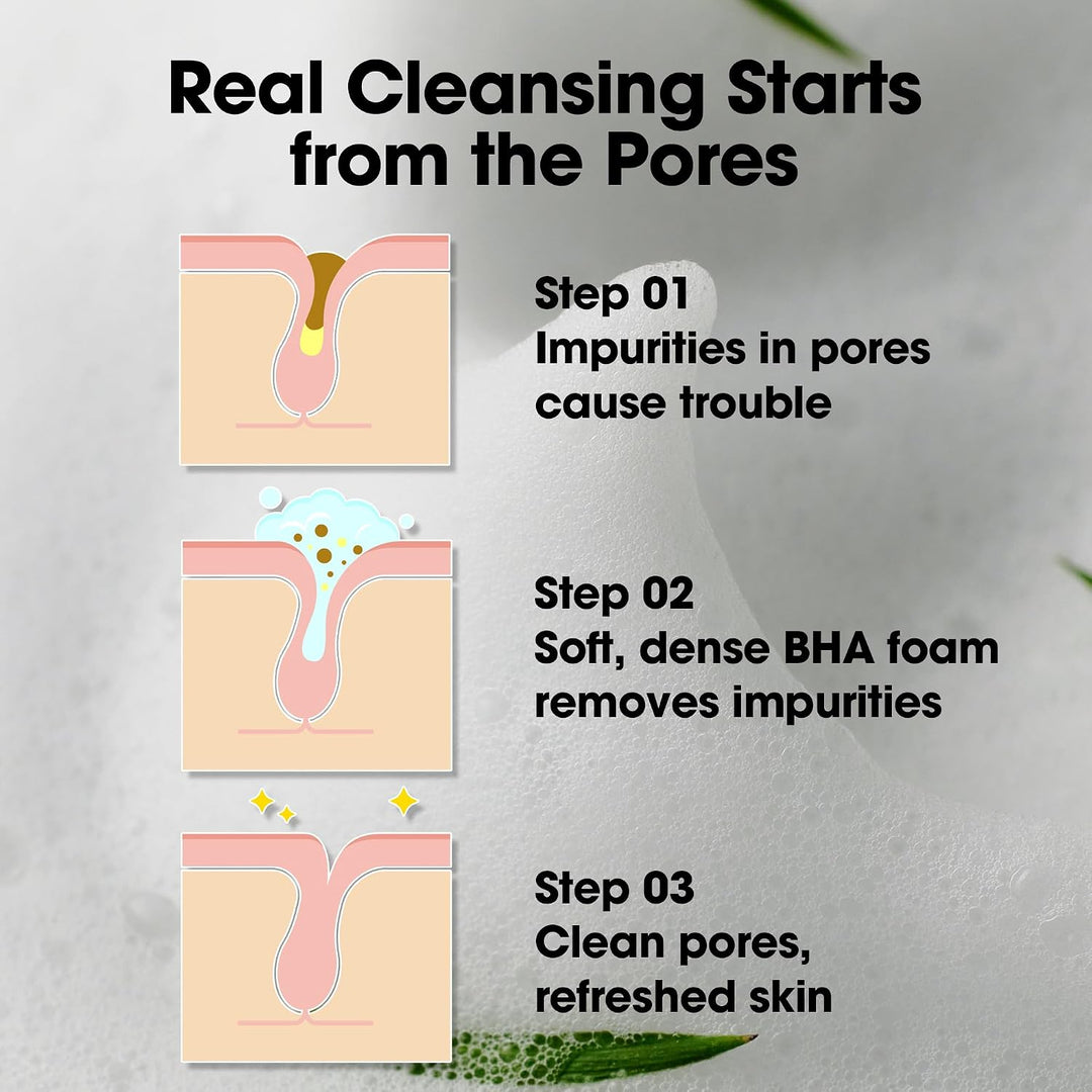 SOME BY MI AHA BHA PHA 30 Days Miracle Acne Clear Foam - 100ml |  سوم باي مي غسول AHA BHA PHA لإزالة حب الشباب من دايز ميراكل - 100 مل