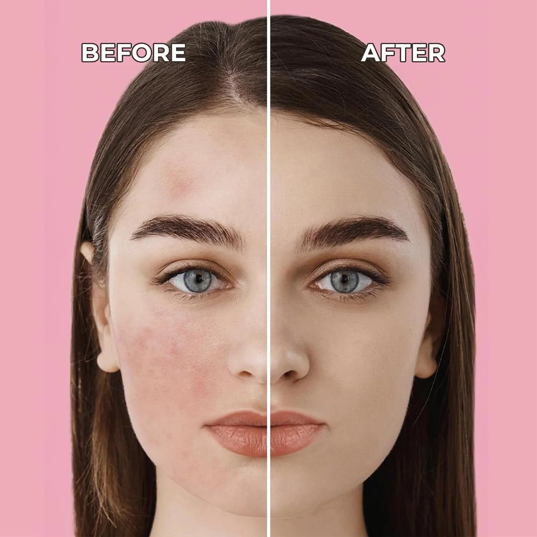Sinoz, Pink Touch Colour Correcting Treatment - 50m | سينوز بينك تاتش علاج تصحيح لون البشرة – 50 مل