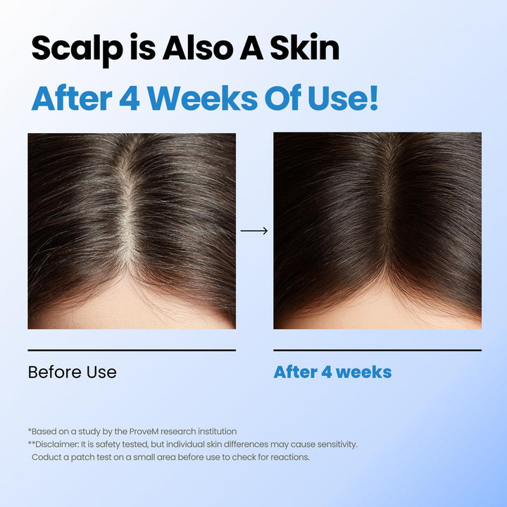Seapuri Scalpy Hair Serum - 20ml | سيروم سيابوري سكالبي للشعر – 20 مل