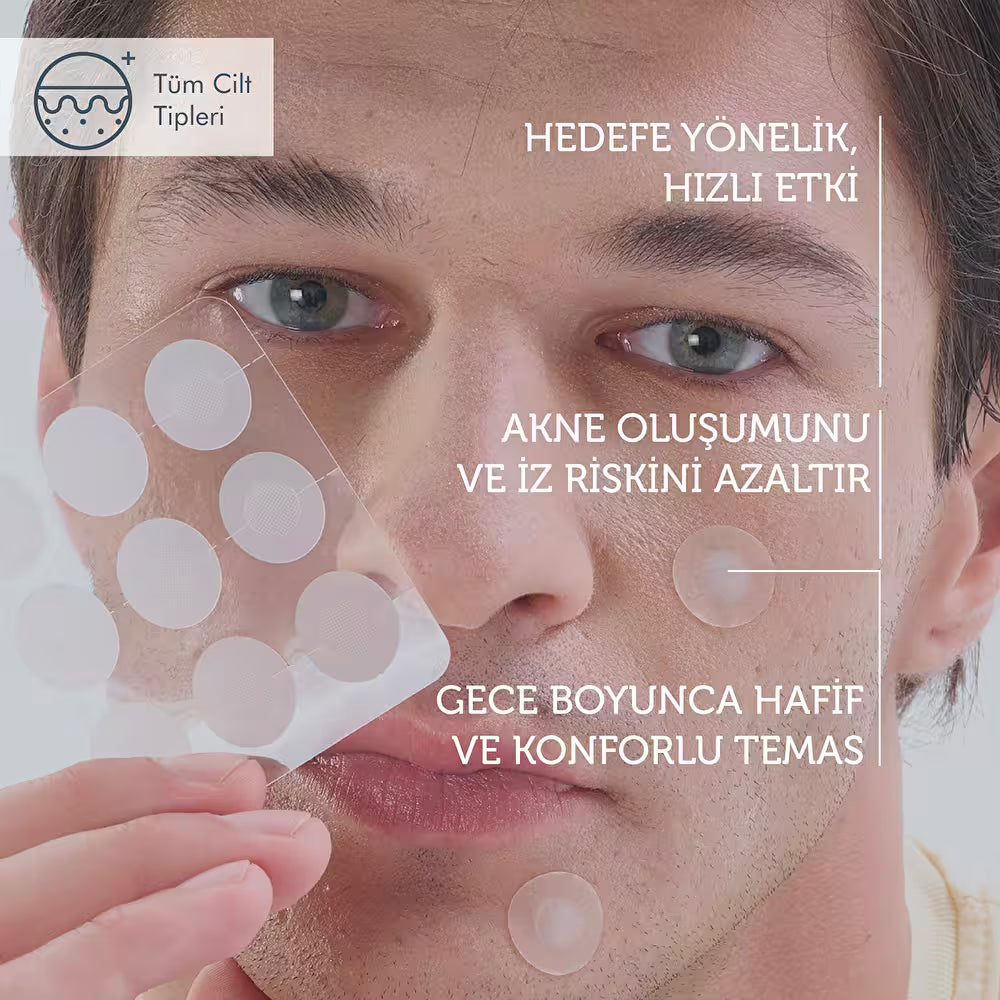 The Purest Solutions Microneedle Technology Acne Patches *9 Patches | ذا بيورست لصاقات علاج حب الشباب - 9 لصاقات