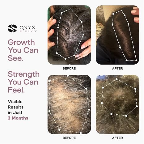 ONYX LactoPherma Advanced Hair Serum - 50ml | أونيكس سيروم للشعر - 50مل