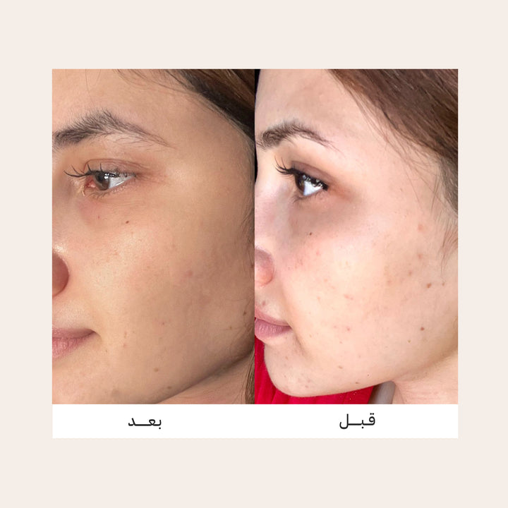 VIVIAN Active Capsules Dark Spot & Brightening Serum - 30ml | فيفيان سيروم الكبسولات النشطة لتفتيح البشرة وتقليل مظهر البقع الداكنة - 30 مل