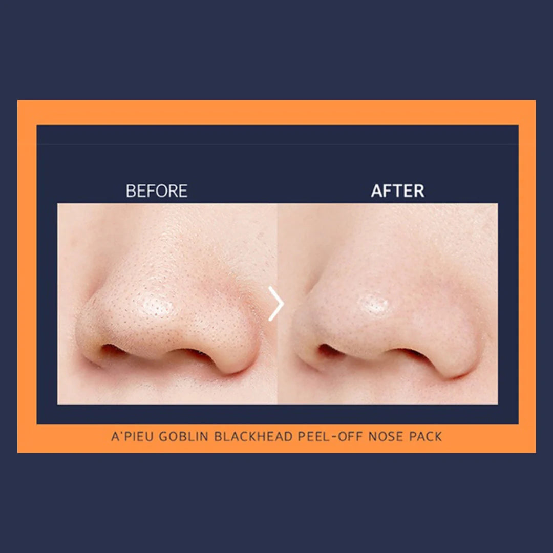 A`pieu Goblin Blackhead 3-Step Nose Pack 3-step cleansing and smoothing patches for the nose |  اپيو لصقات الأنف ثلاثي المراحل لإزالة الرؤوس السوداء