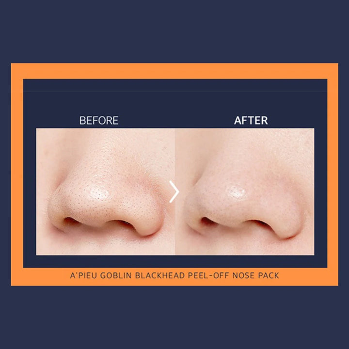 A`pieu Goblin Blackhead 3-Step Nose Pack 3-step cleansing and smoothing patches for the nose |  اپيو لصقات الأنف ثلاثي المراحل لإزالة الرؤوس السوداء