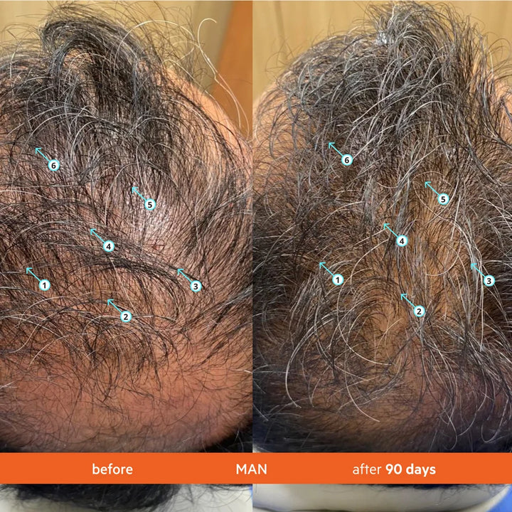 DS LABS Revita High Performance Hair DENSITY Conditioner - 205ml | ريفيتا بلسم لكثافة الشعر - 205مل