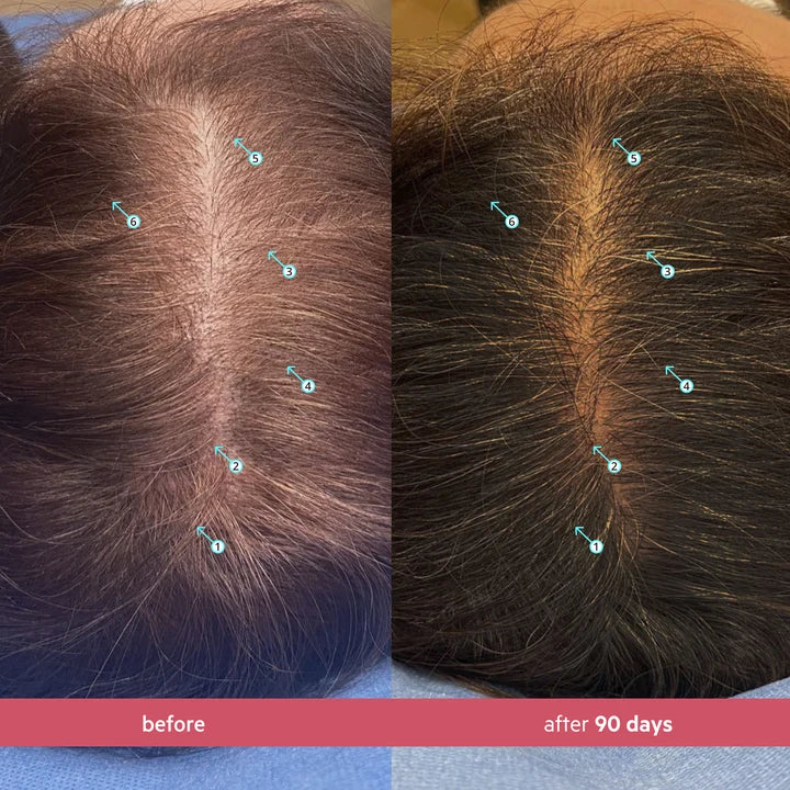 DS Labs Spectral Women's Hair Density Serum for Thinning Hair - 60ml | دي اس لابز سيروم لتعزيز كثافة الشعر للنساء - 60مل