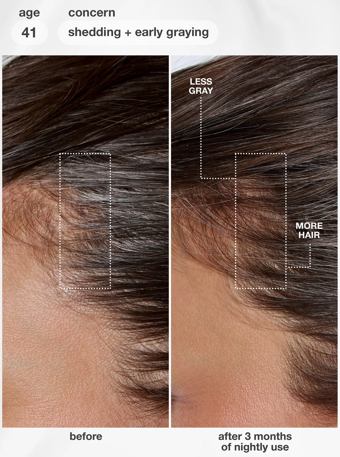 K18 FutureIQ Biomimetic Hair Longevity Serum -90ml |كي 18 سيروم الشعر لتقوية الجذور والعناية بفروة الرأس - 90 مل