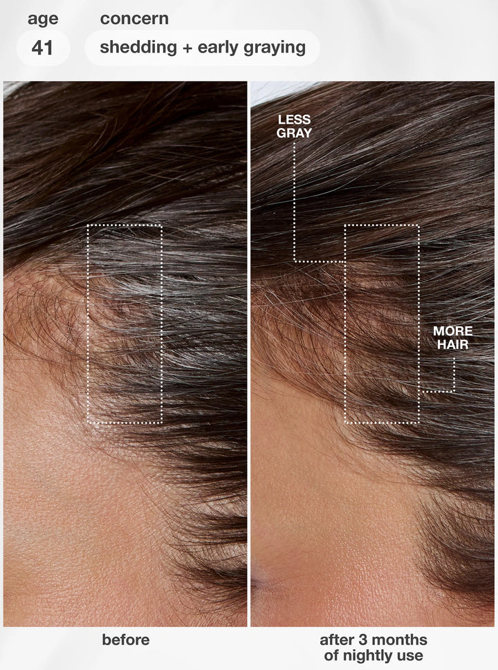 K18 FutureIQ Biomimetic Hair Longevity Serum -90ml |كي 18 سيروم الشعر لتقوية الجذور والعناية بفروة الرأس - 90 مل