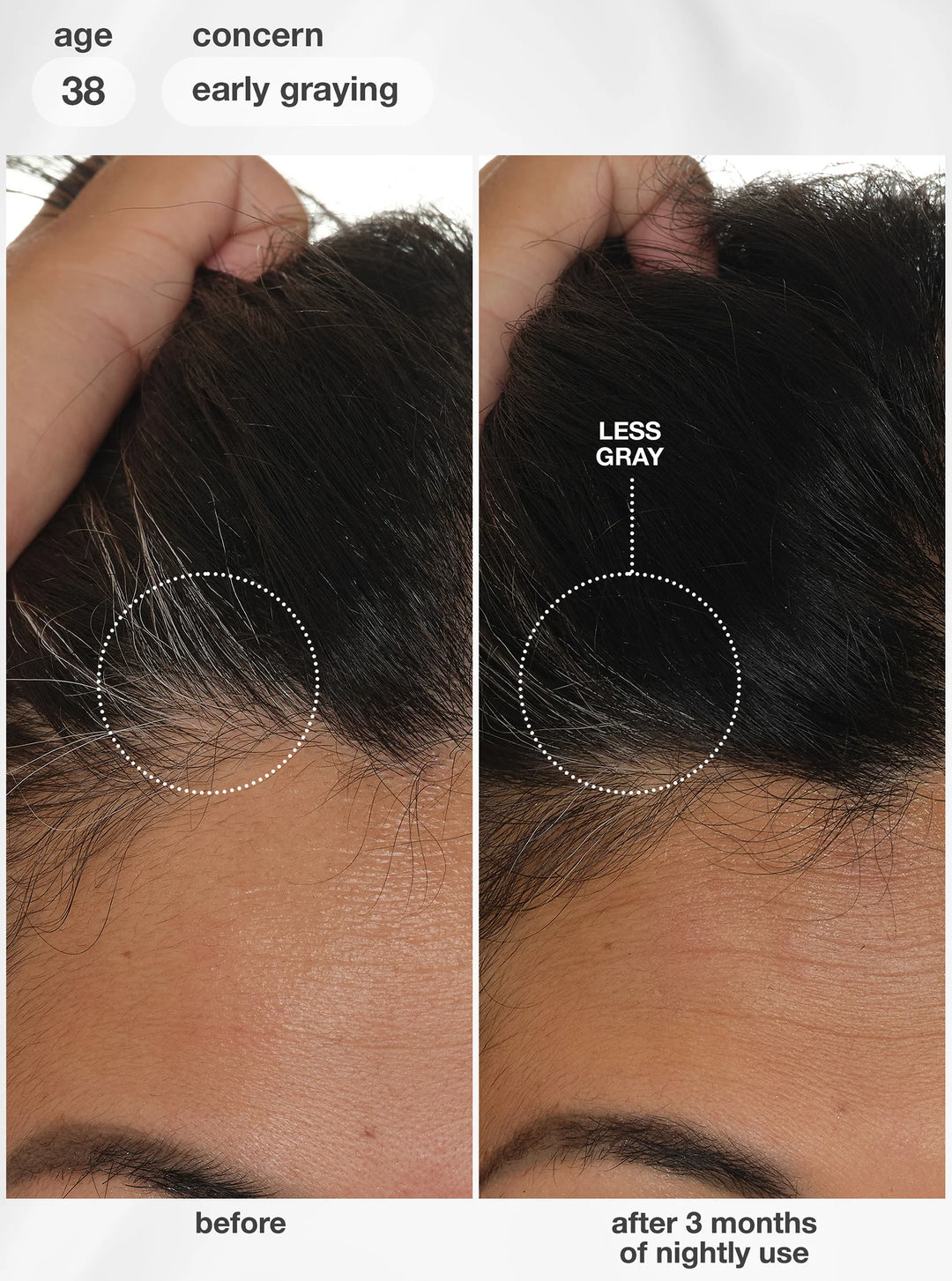K18 FutureIQ Biomimetic Hair Longevity Serum -90ml |كي 18 سيروم الشعر لتقوية الجذور والعناية بفروة الرأس - 90 مل