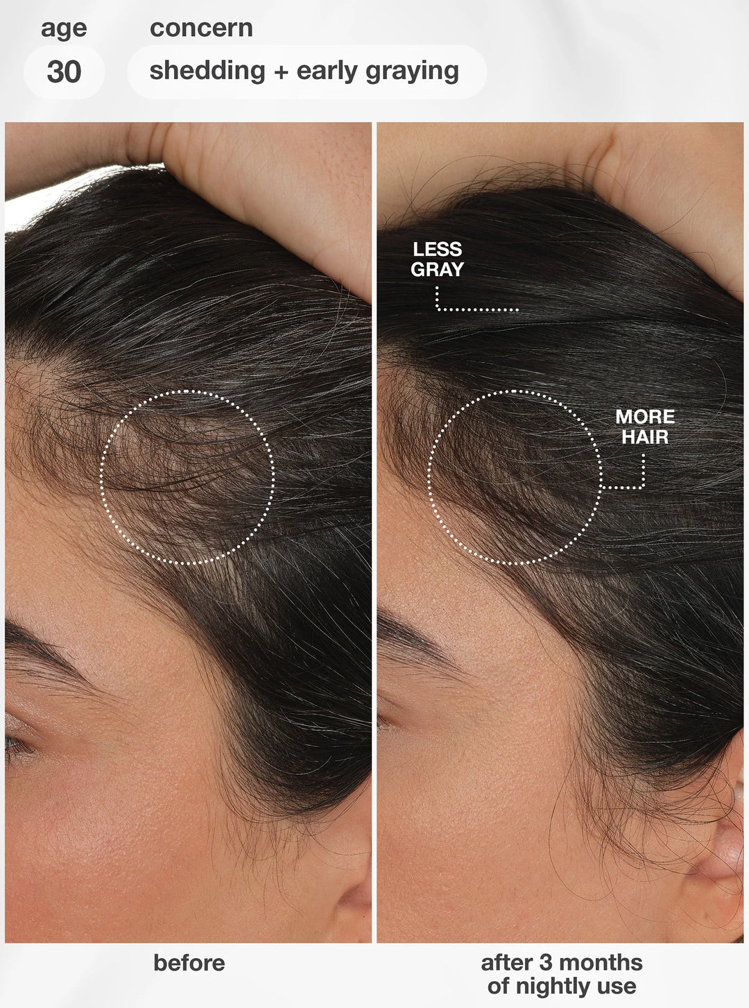 K18 FutureIQ Biomimetic Hair Longevity Serum -90ml |كي 18 سيروم الشعر لتقوية الجذور والعناية بفروة الرأس - 90 مل