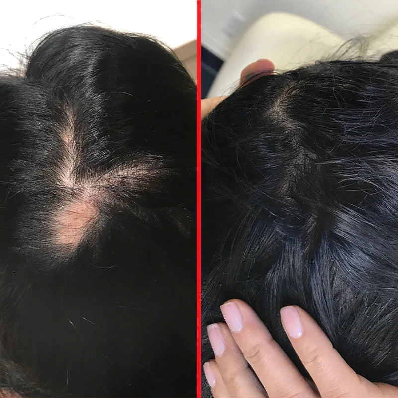 Hair Tamin Advanced Formula  - 30 vegan capsules |  مكمل غذائي للشعر - 30 كبسول