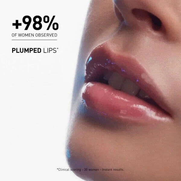 FILORGA Hyalu-Filler Lips - 4g | فيلورغا هايالو-فيلر شفايف - 4 جرام