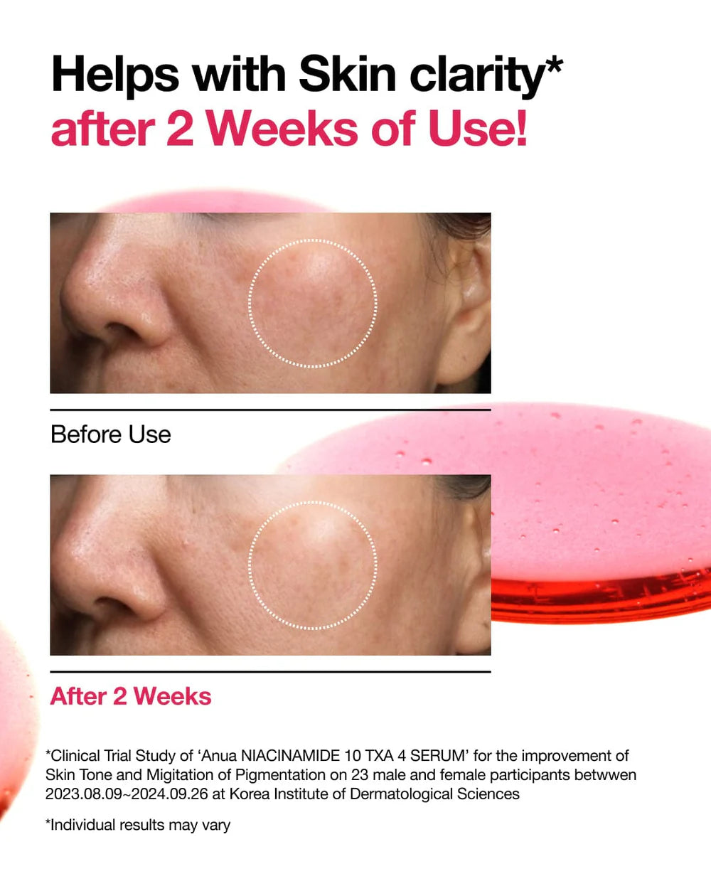 Anua Niacinamide 10% + TXA 4% Serum - 30ml | أنوا سيروم النياسيناميد 10% + حمض الترانكسميك 4% - 30 مل