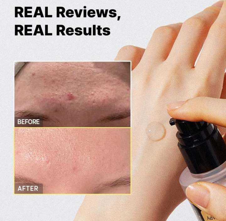 Cosrx Advanced Snail 96 Mucin Power Essence - 100ml |كوزركس سيروم ايسنس بخلاصة الحلزون المركز - 100 مل