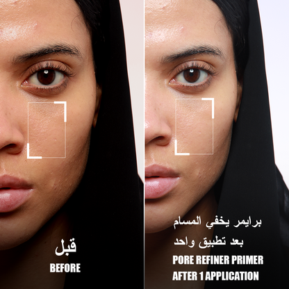 FOR EVER52 Layered Pore Refine - 20g | لايريد كريم تصفية المسام - 20غ #4