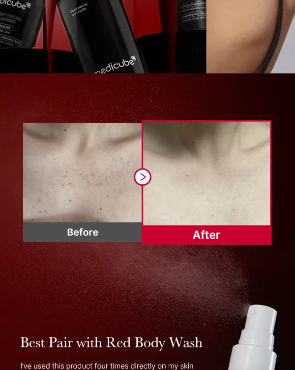 medicube Red Acne Body Peeling Shot - 110g | ميدي كيوب مقشر الجسم الأحمر - 110 غرام