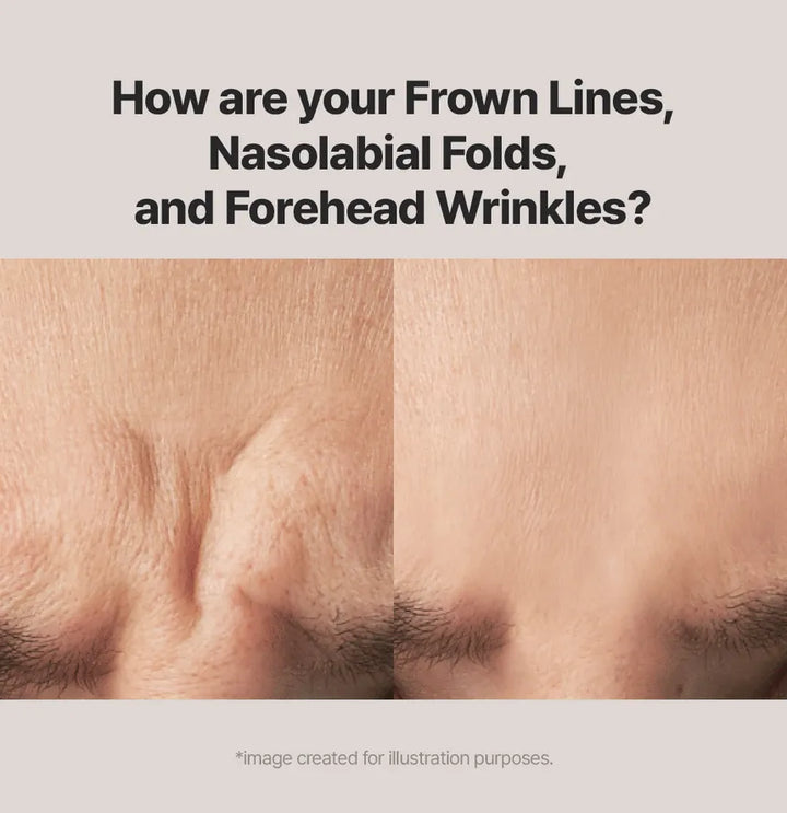 MARSHIQUE Wrinkle Repair Nasolabial Fold Patch 60 pcs | مارشيك لصاقات مقاومة للتجاعيد - 60 قطعة