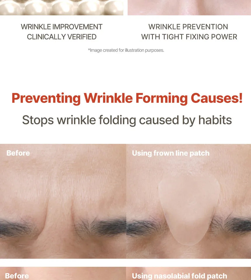 MARSHIQUE Wrinkle Repair Nasolabial Fold Patch 60 pcs | مارشيك لصاقات مقاومة للتجاعيد - 60 قطعة