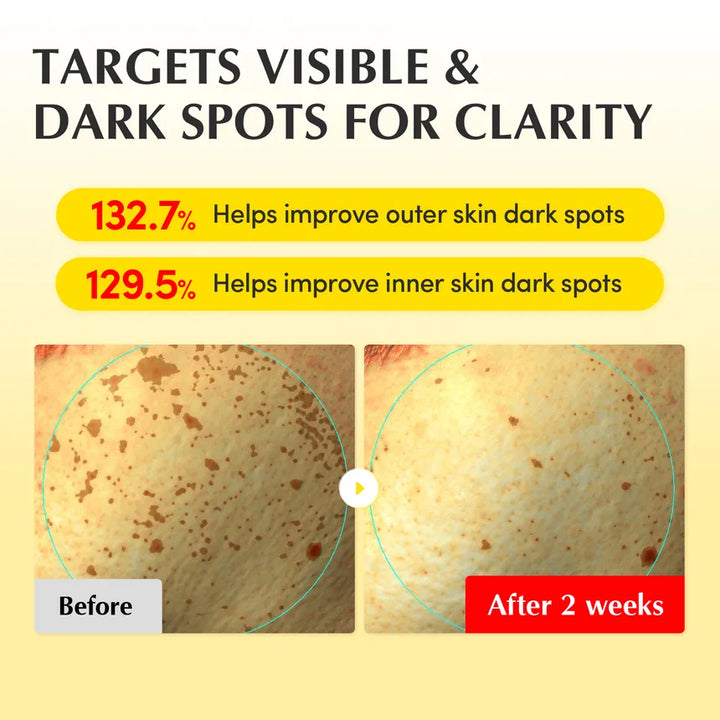 EQQUAL BERRY VITAMIN ILLUMINATING CREAM - 50ml | ايكوال بيري كريم فيتامين سي مضيء - 50مل
