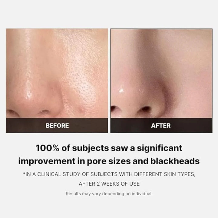 Medicube ZERO PORE PAD 2.0 - 70pcs | ميدي كيوب وسائد تونر - ٧٠ قطعة