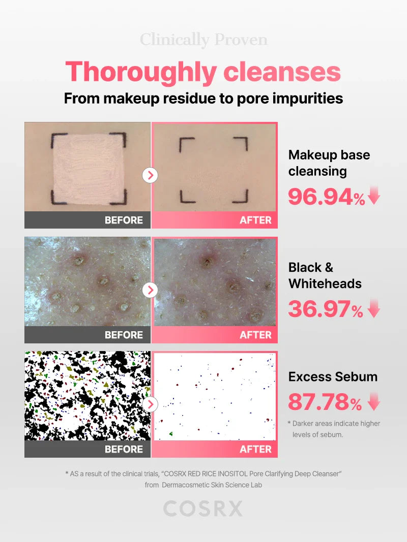 COSRX - Red Rice Inositol Pore Clarifying Deep Cleanser - 150ml |  كوزركس غسول عميق لتنقية المسام بالأرز الأحمر والإينوزيتول – 150 مل