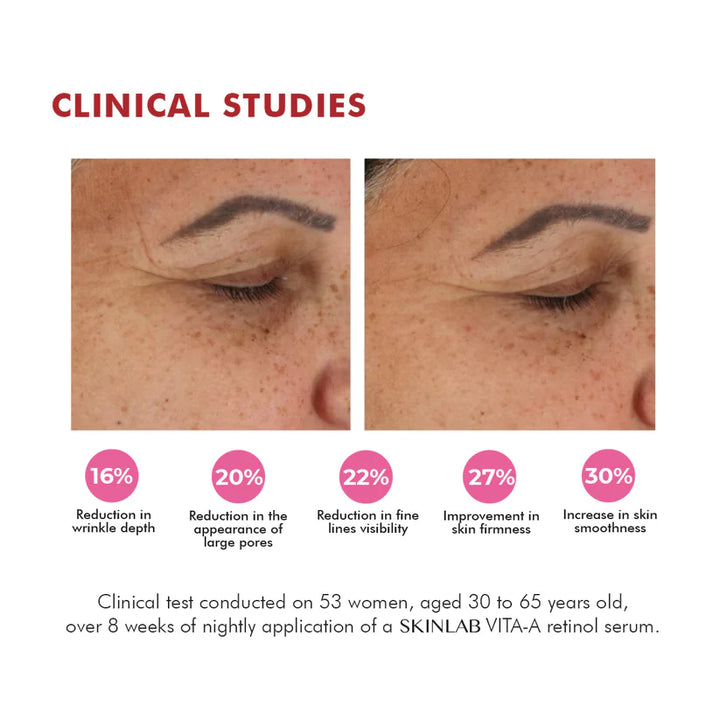 SKINLAB VITA-A Serum Retinol & Vitamin A - 30ml | سيروم سكينلاب فيتا ايه بالريتينول وفيتامين ايه – 30 مل