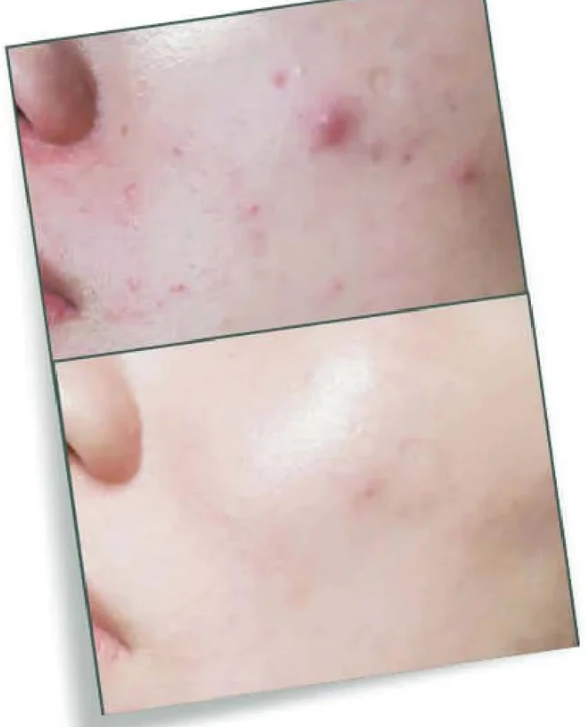 LA JU Niacinamide Serum - 30 ml | لاجو سيروم لعلاج حب الشباب - 30 مل