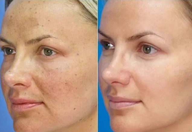 LA JU Hyaluronic Acid Cream - 40g | لاجو كريم مرطب للوجه بالهيالورونيك اسيد - 40 غرام