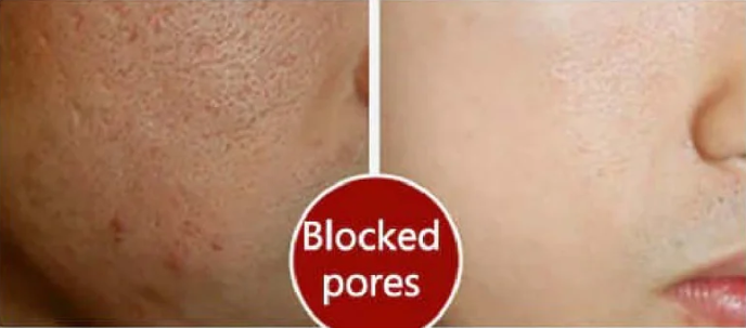LA JU Pore Treatment Serum - 20ml | لاجو سيروم معالج للمسام - 20 مل