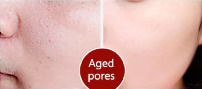 LA JU Pore Treatment Serum - 20ml | لاجو سيروم معالج للمسام - 20 مل