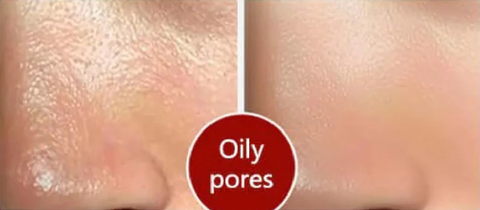 LA JU Pore Treatment Serum - 20ml | لاجو سيروم معالج للمسام - 20 مل
