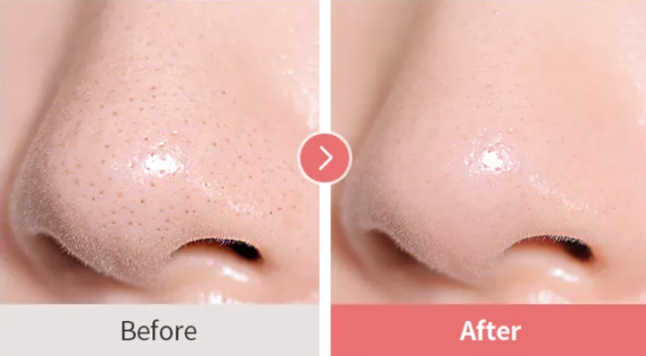 TOCOBO Calamine Pore Control Cleansing Oil - 200ml | توكوبو غسول زيتي بالكالامين للسيطرة على المسام - 200 مل
