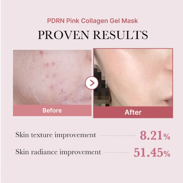 Medicube PDRN Pink Collagen Gel Mask 1 Sheet x 4 - 20g |ميدي كيوب ماسك جل الكولاجين الوردي PDRN - 4 قطع × 20 غرام