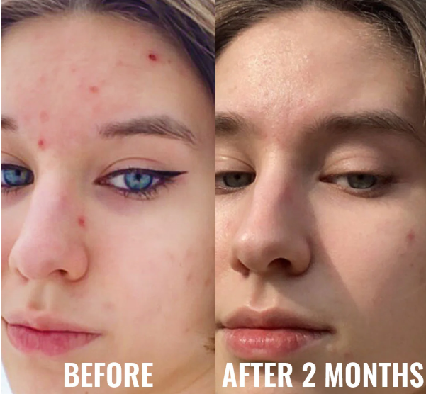 GOOD MOLECULES Niacinamide Serum - 30ml | جود موليكيولز سيروم النياسيناميد - 30 مل