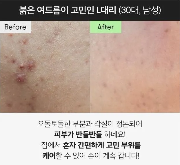 APLB Glutathione Niacinamide Ampoule Serum - 40ml | سيروم الجلوتاثيون و النياسيناميد -  40مل