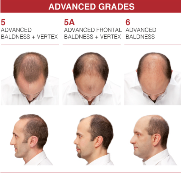 CRESCINA TRANSDERMIC HFSC RE-GROWTH 1300 For Men- 3.5ml x 20 - 20pcs | كريشنا امبولات ضد تساقط الشعر للرجال 1200 - 3.5 مل x 20 - 20 قطعة